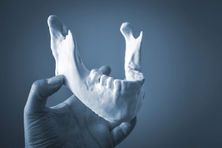 A girl holds a mandible printed on a 3d printer on her palm